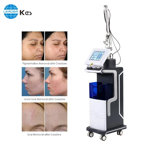40w 10600nm Trixel Fractional Co2 Laser Handpiece Fractional Co2 Fractional Laser Skin Resurfacing